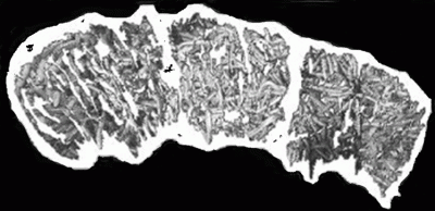 logo Grotesque Bowel Eruption